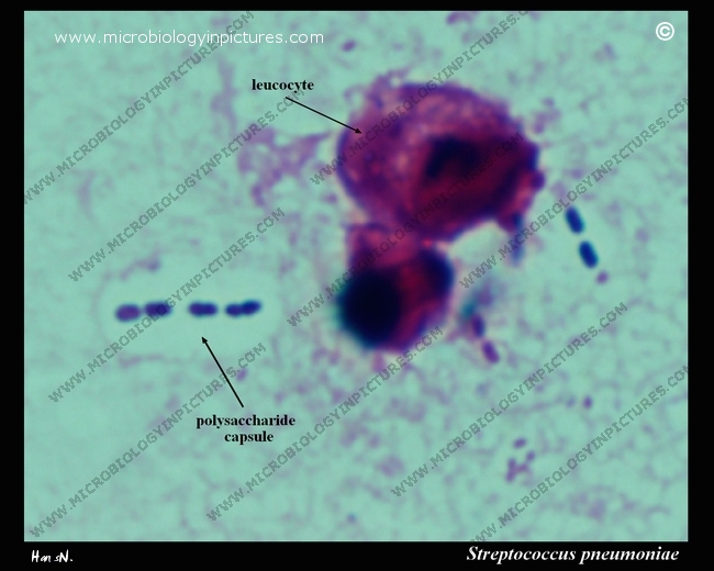 streptococcus pneumoniae with a polysaccharide capsule
